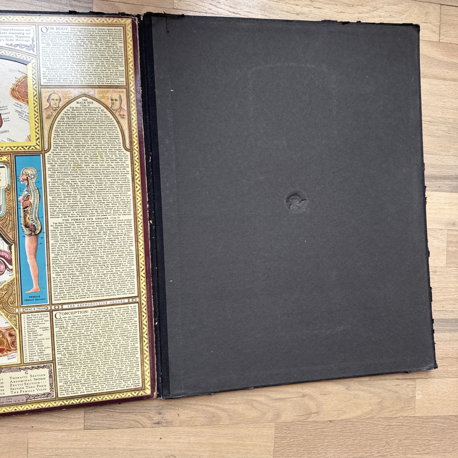 Bodyscope by Ralph H. Segal Human Anatomy Medical Chart and Case 1948 Flaws