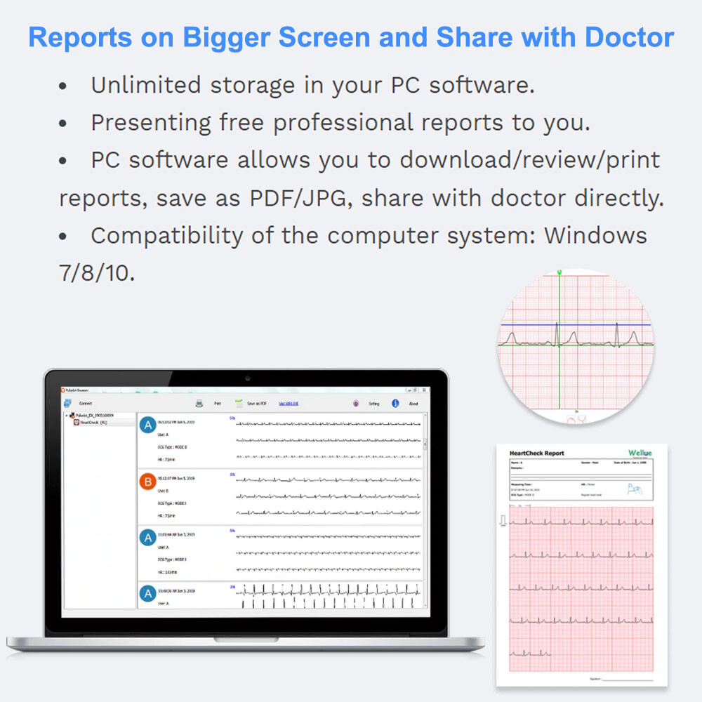 ECG EKG Monitor 30s/60s/5min Recording AI-ECG Analysis Report in App PC Software