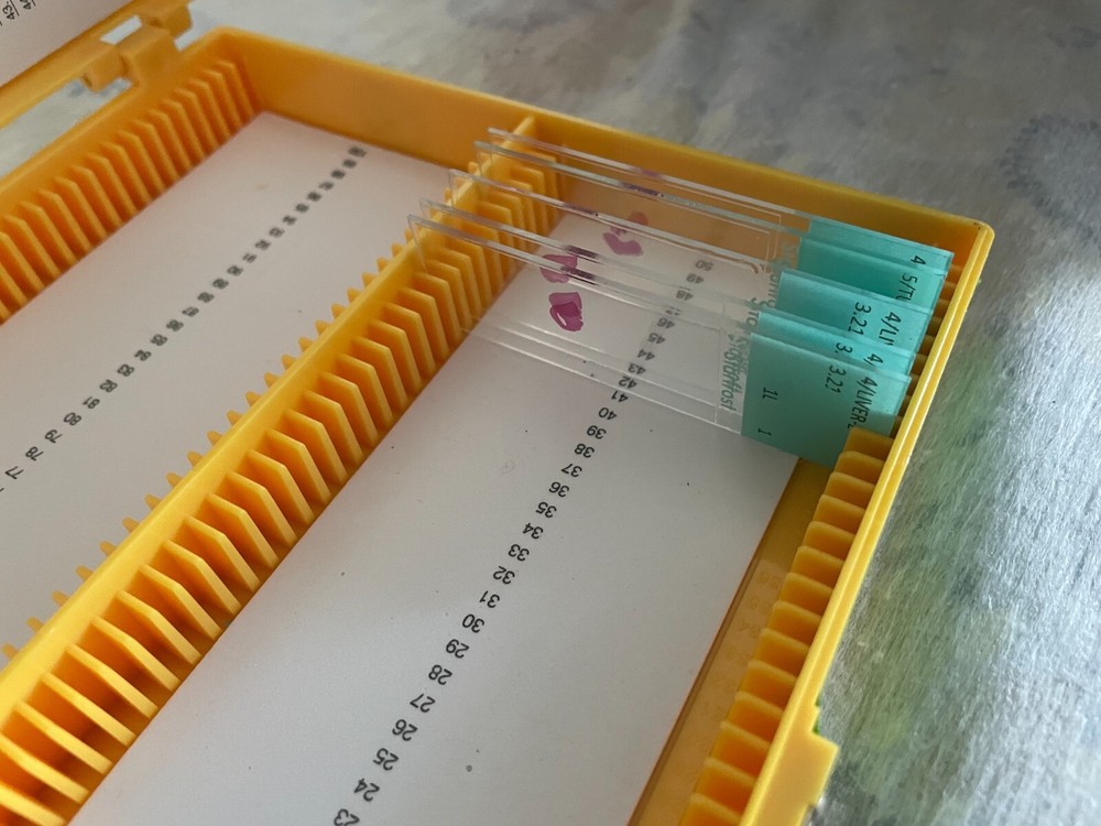 Two Microscope storage boxes with mouse tissues slides