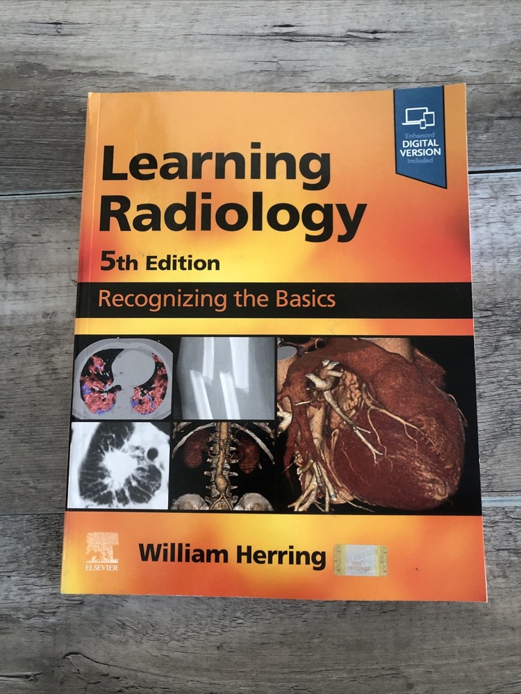 Learning Radiology : Recognizing the Basics by William Herring (2023)
