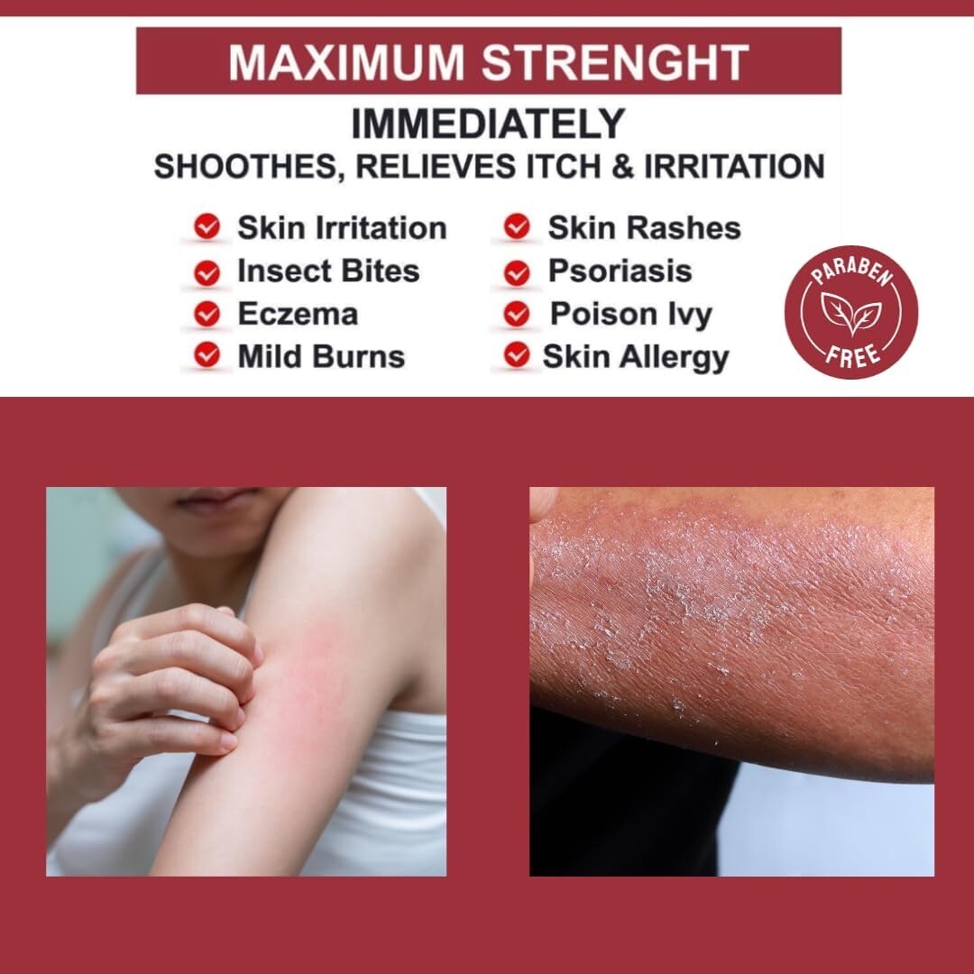 Quatriderm* Crema NF 1% Hydrocortisone - Anti-Itch Cream With Aloe Vera