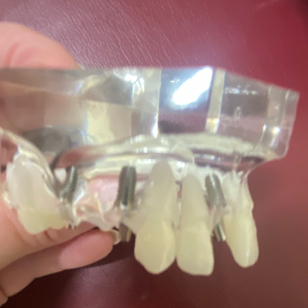 Practicon Transparent Implant Crown & Bridge Typodont Model 4071920 Dentistry