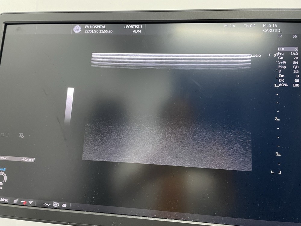 GE Ultrasound probe Linear ML6-15D