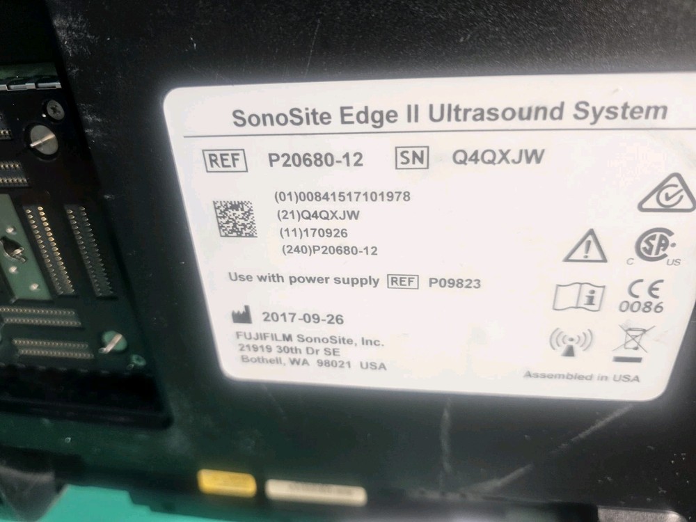 Sonosite Edge II Ultrasound System