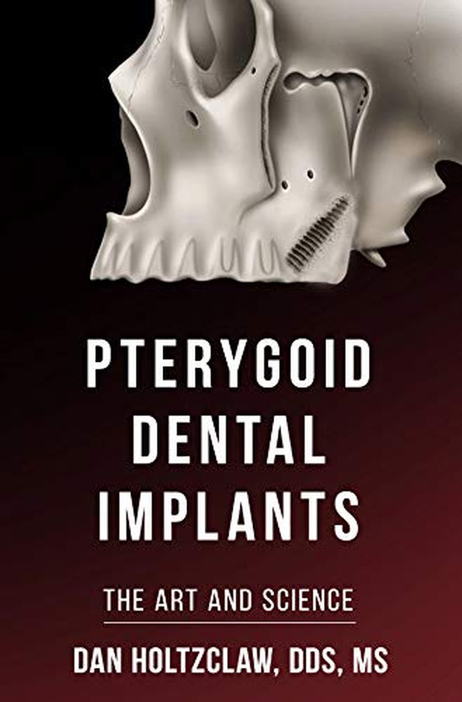 Pterygoid Implants: the Art and Science