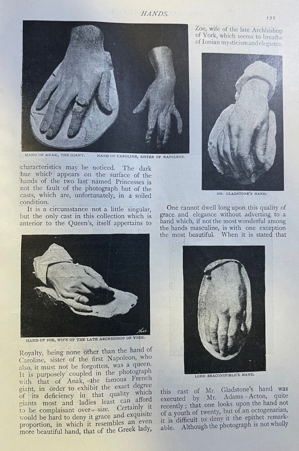 1903 Hands illustrated