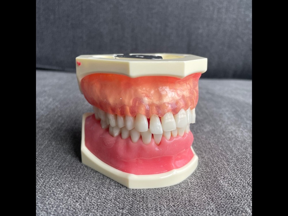 Periodontics Dentoform (Used in Simulation Lab)