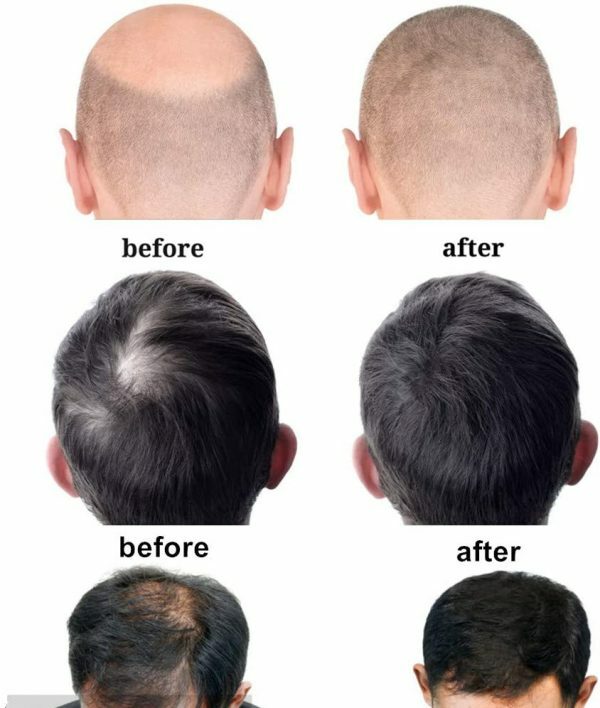 224 LEDs 880nm Infrared Red Light Hair Cap for Hair Loss Regrowth Helmet Device