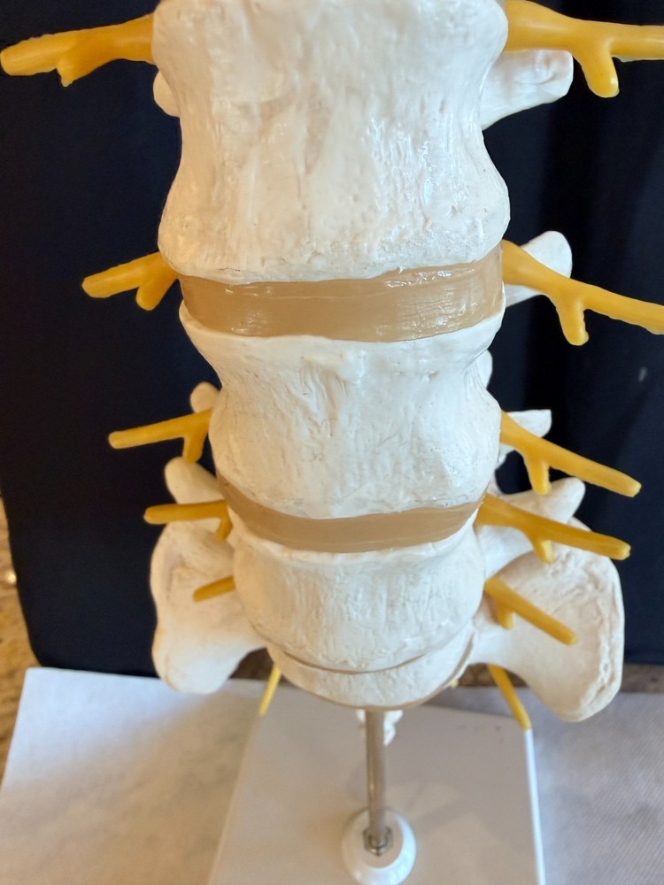 Lumbar Spine Model A74 - 3B Scientific
