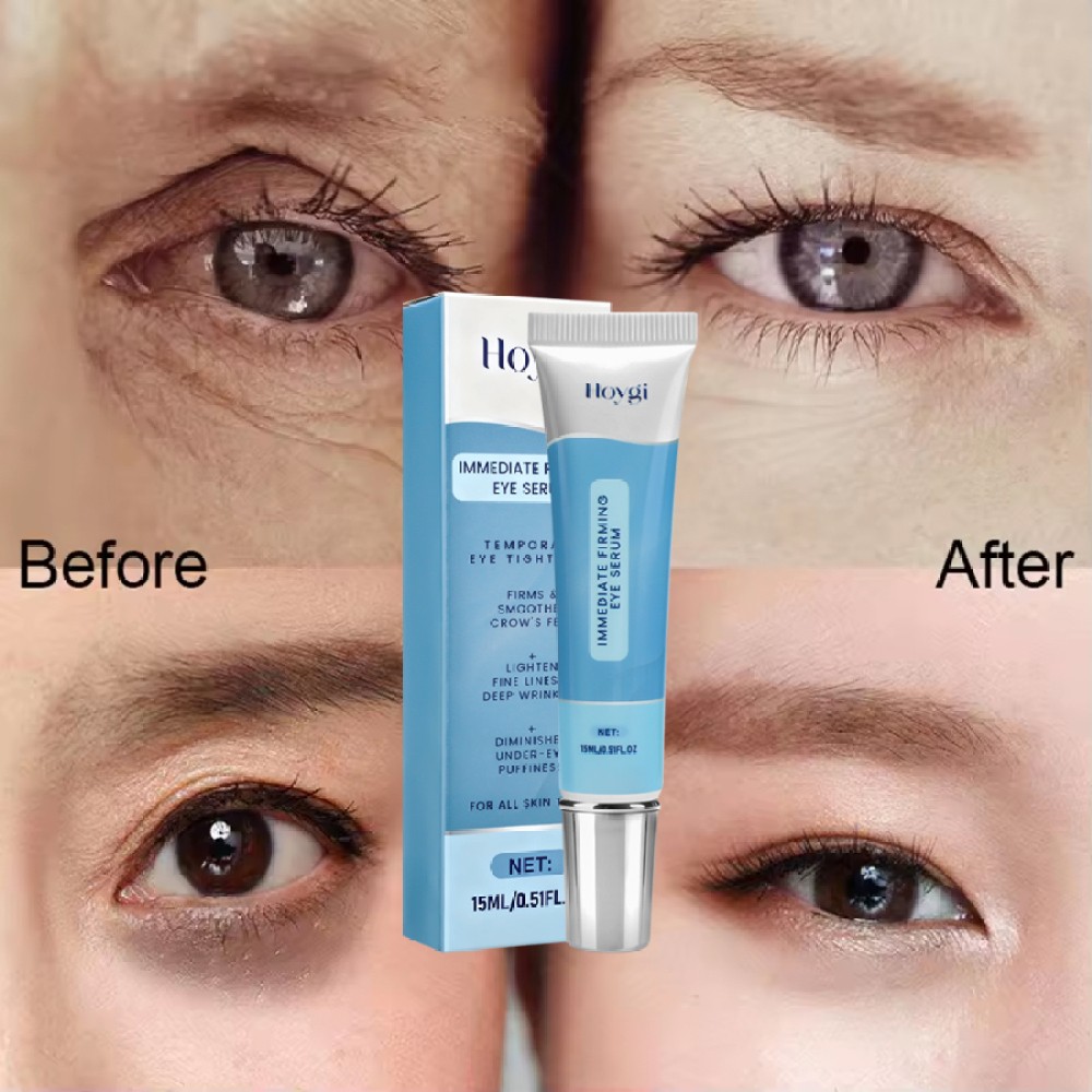 3-Under Eye Cream Remove Dark Circles Bags Face Lines Ageless Wrinkles Puffy Eye