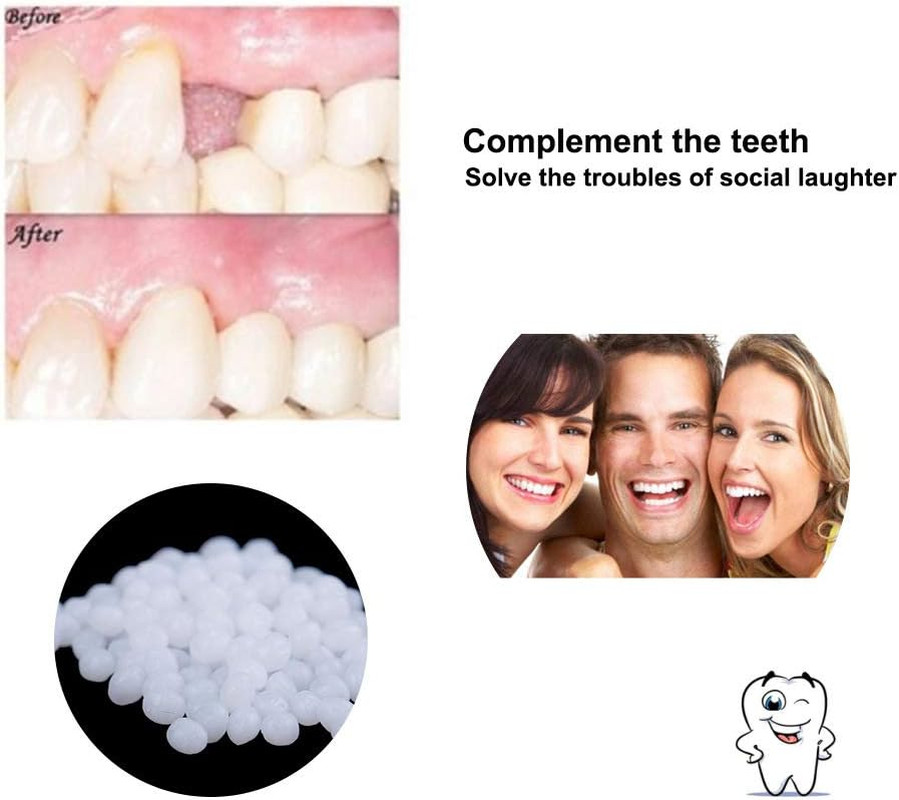 3 Colors Temporary Moldable False Teeth Repair Replacement Thermal Fitting Bea..