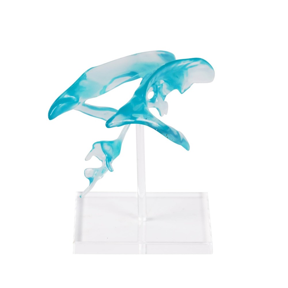 Human Brain Ventricle Model, Enlarged Brain Ventricle Anatomy Model with Cent...