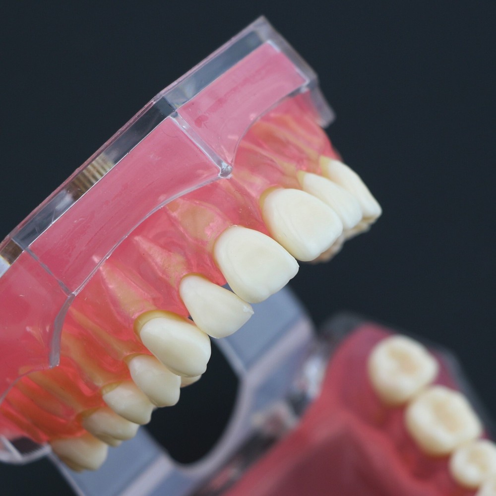 Dental Typodont Practice Study Standard Teeth Model 28 Pcs Removable Teeth M7008