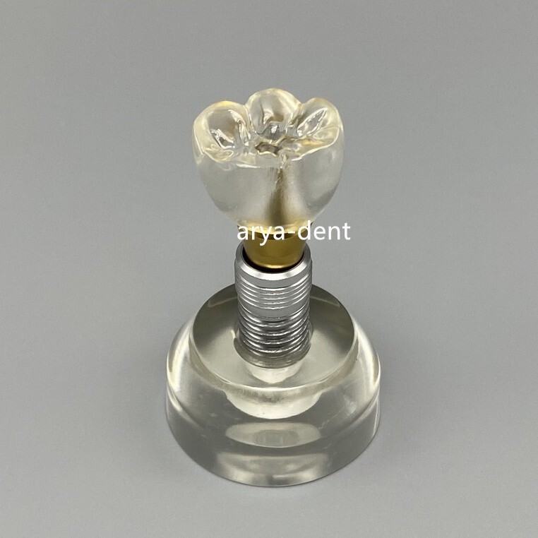 Dental Typodont Implant Teeth Model Demonstration Teeth Study Teach Model M2020