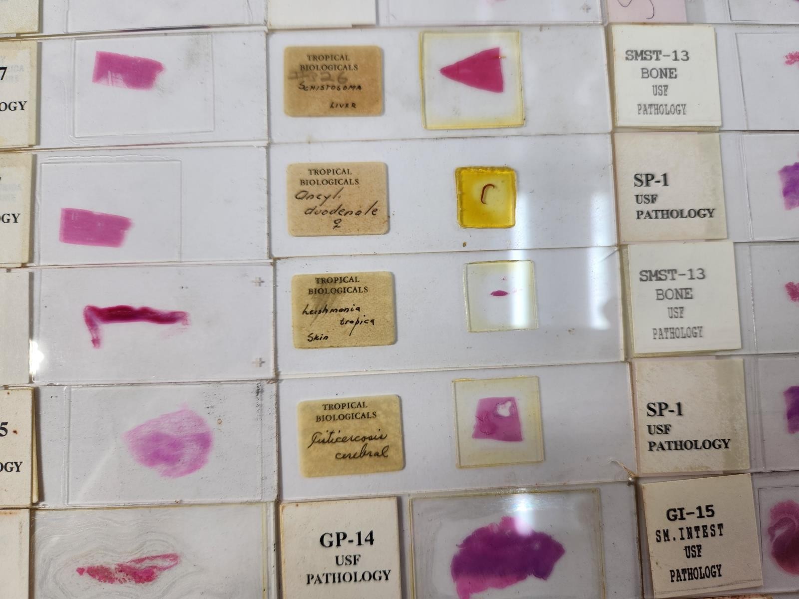 Lot Of 50 Vintage University Prepared Pathology Microscope Slides - Slides Only