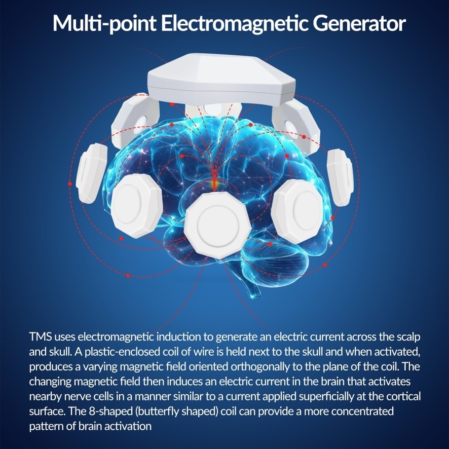 Transcranial Magnetic Stimulation rTMS Machine Cranial Nerve Center Stimulator