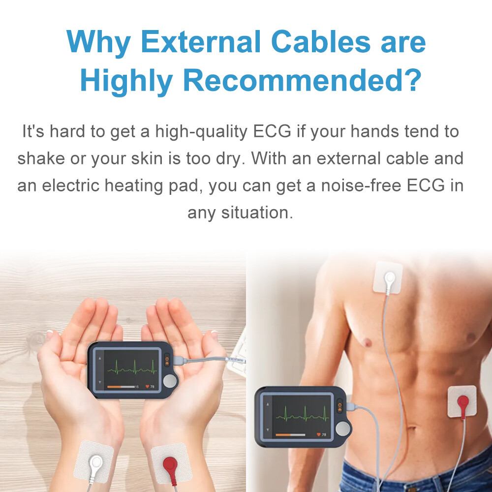 ECG EKG Monitor 30s/60s/5min Recording AI-ECG Analysis Report in App PC Software
