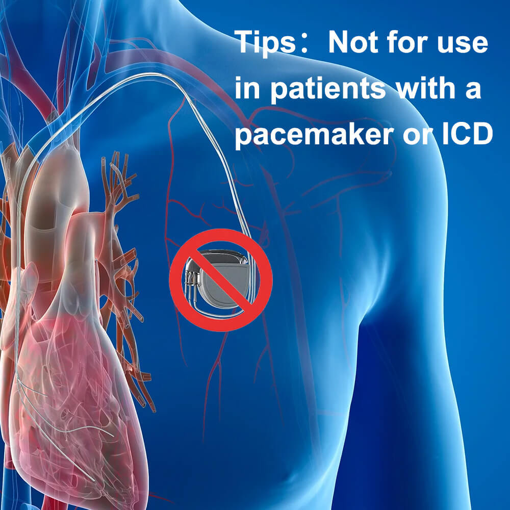 Holter Monitor 24 hours EKG Monitor ECG Recording PC Software Free AI Analysis