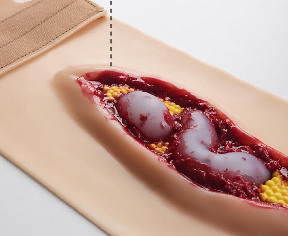 Abdominal Anatomical Wound Training Model