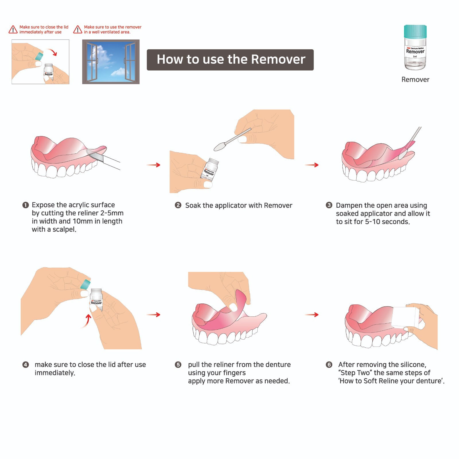 Denture Soft Reline Kit – Long-Lasting Soft Grip, Easy to Apply-Single Use