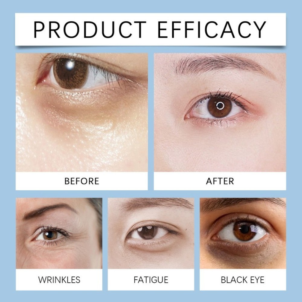 3-Under Eye Cream Remove Dark Circles Bags Face Lines Ageless Wrinkles Puffy Eye