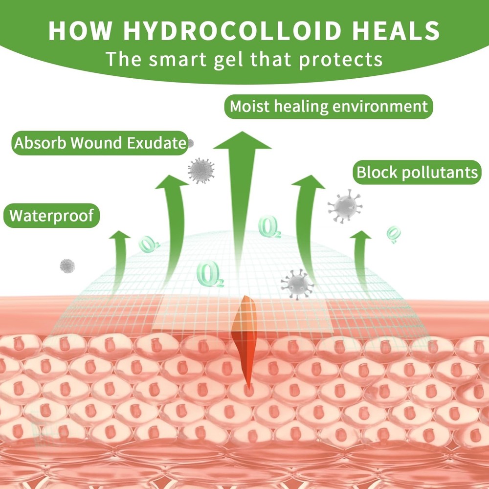 Hydrocolloid Roll for Wound Care 3pcs Individually Sealed, Extra Large Cuttab...