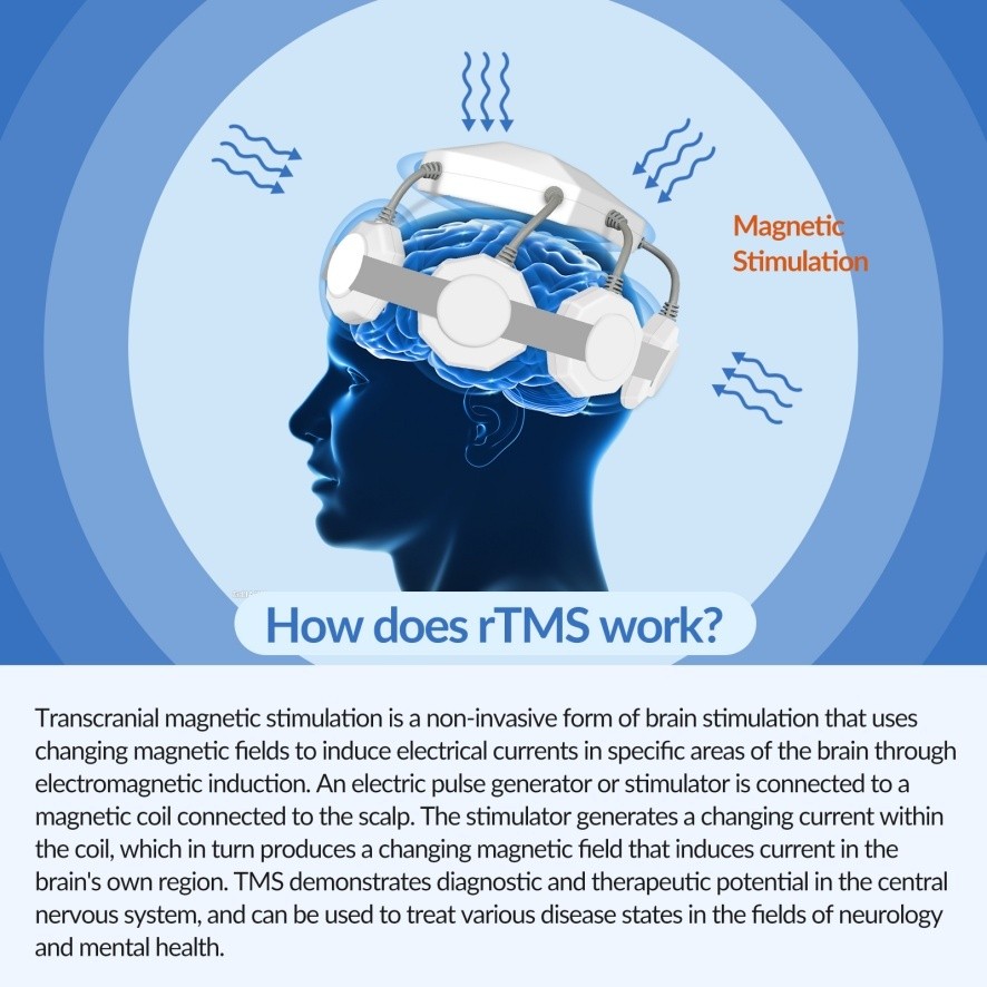 Head Stimulator rTMS Machine Transcranial Magnetic Stimulation for depression