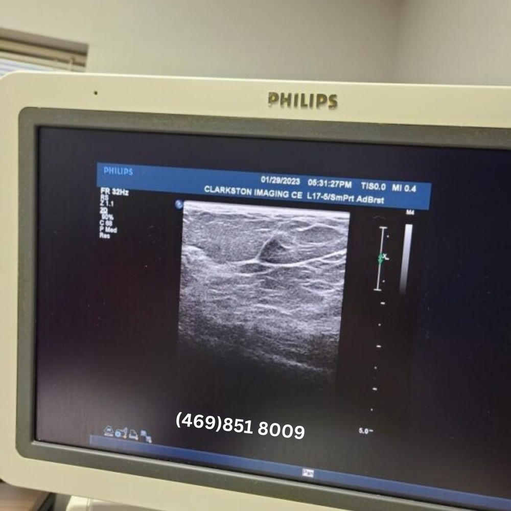 Philips iE33 Ultrasound Support Online FullTech Service
