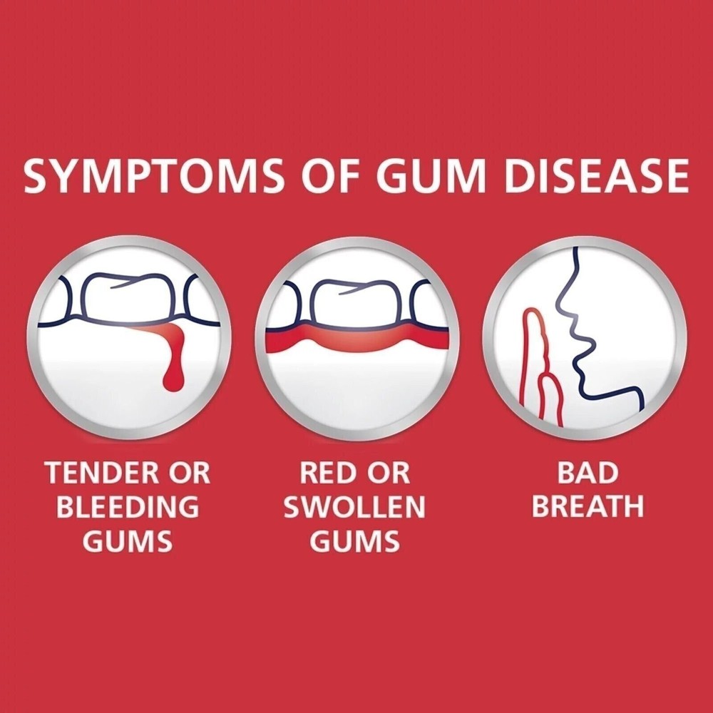 4 Pack Parodontax Clean Mint Toothpaste for Bleeding Gums 3.4oz Each