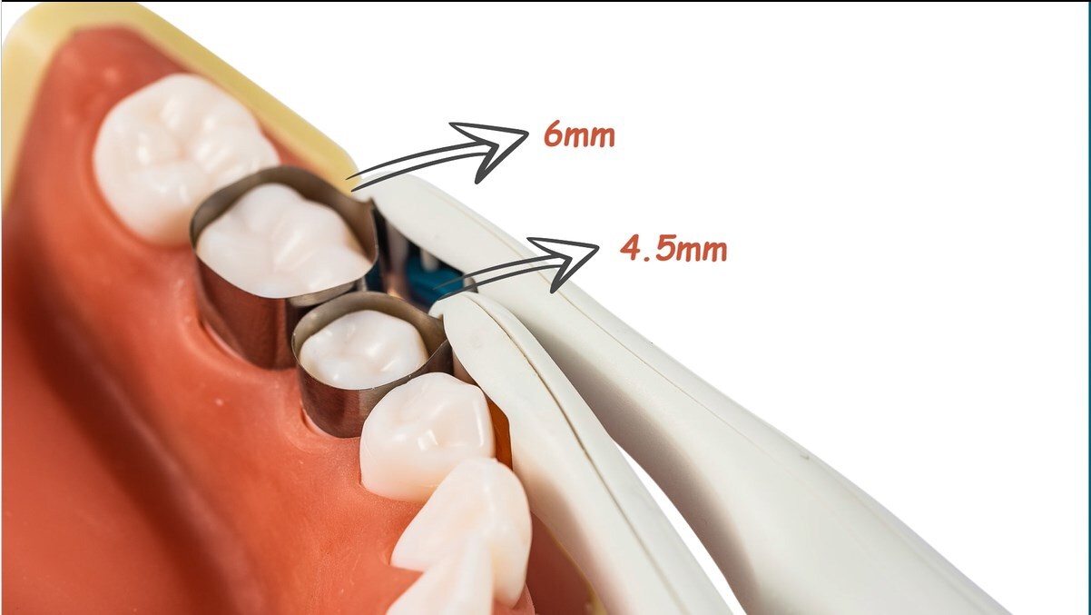 Adjust Dental Pro Matrix Bands Molar/Premolar Restoration Pre Formed 10/20/30Pcs