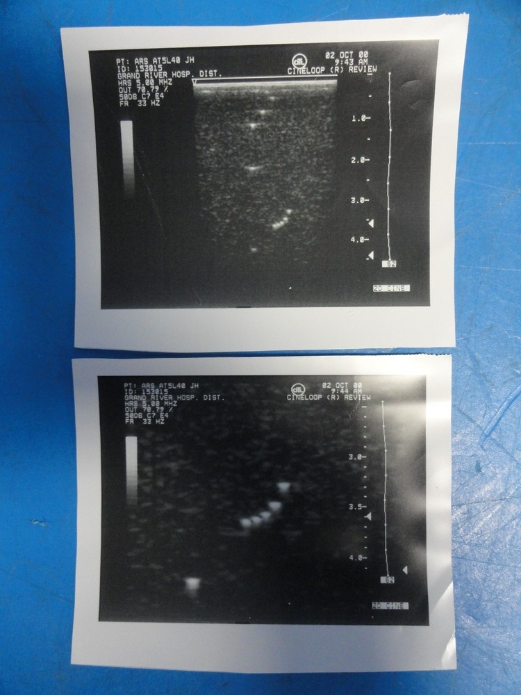 Sonora ARS AT5L40 / ATL 5.0 HRS Linear Array Replacement Transducer ~ 8935