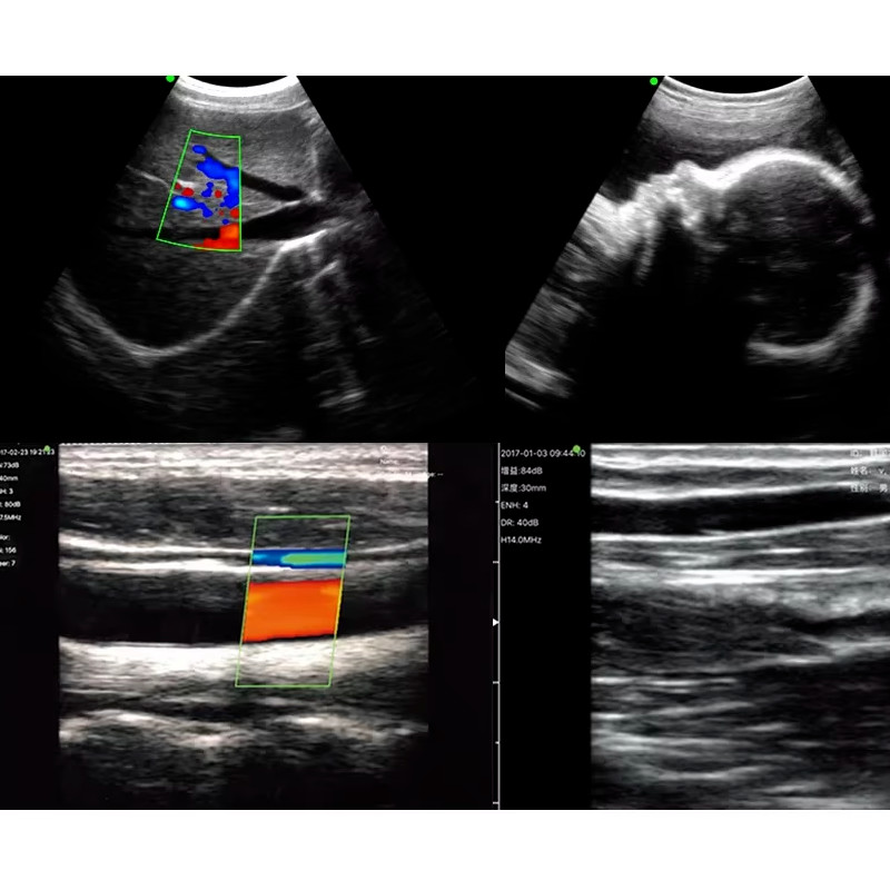 192 Elements upgraded version IOS Android Wifi Windows Wireless Ultrasound Probe