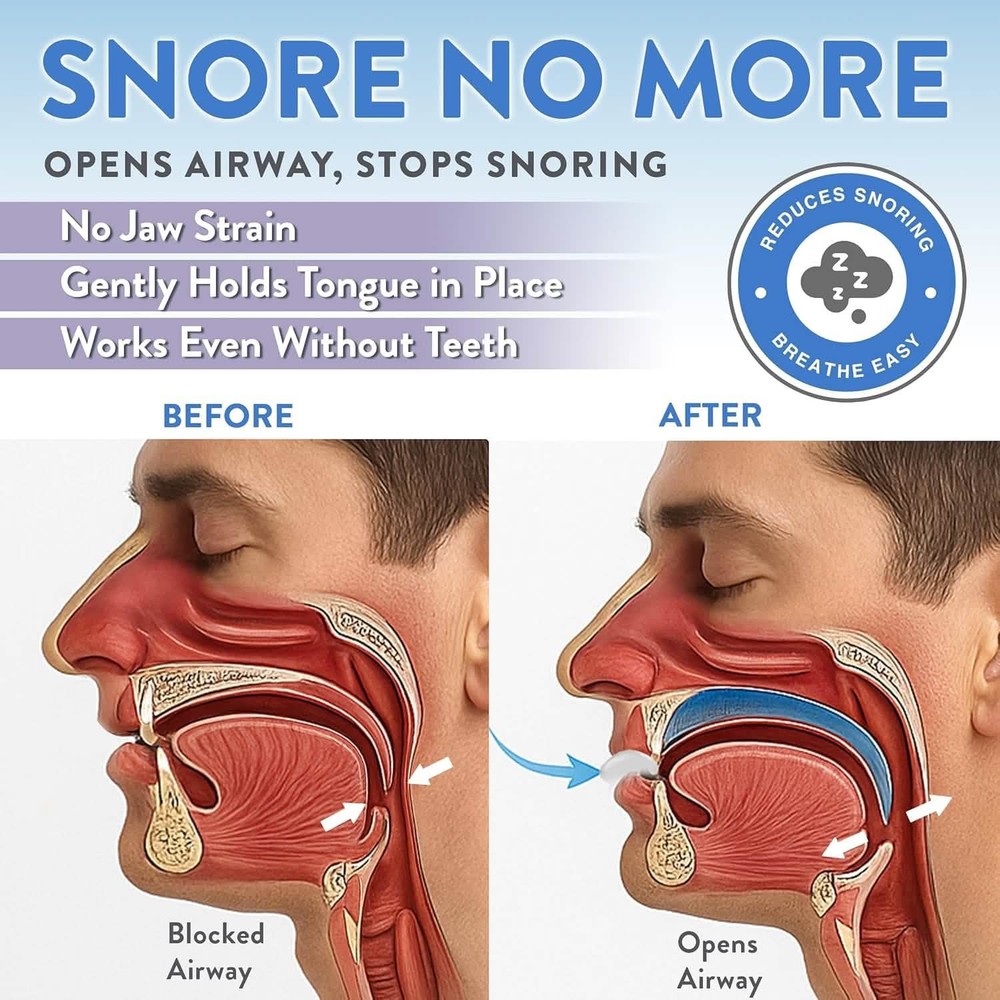 Good Morning Snore Solution® FDA Cleared Two Size Value Starter Pack