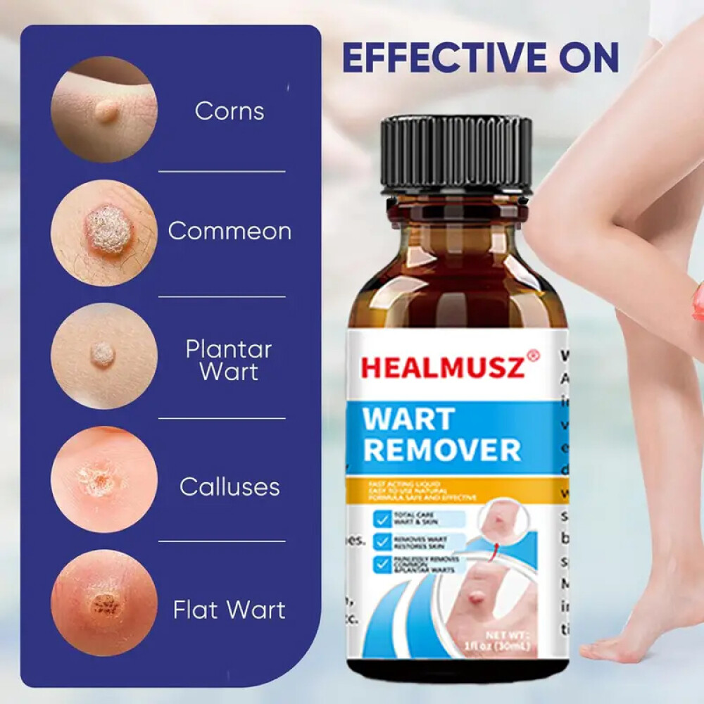 Wart Remover Liquid Skin Tag Mole Remover Eliminate Feet Corn Wart Remove Liquid