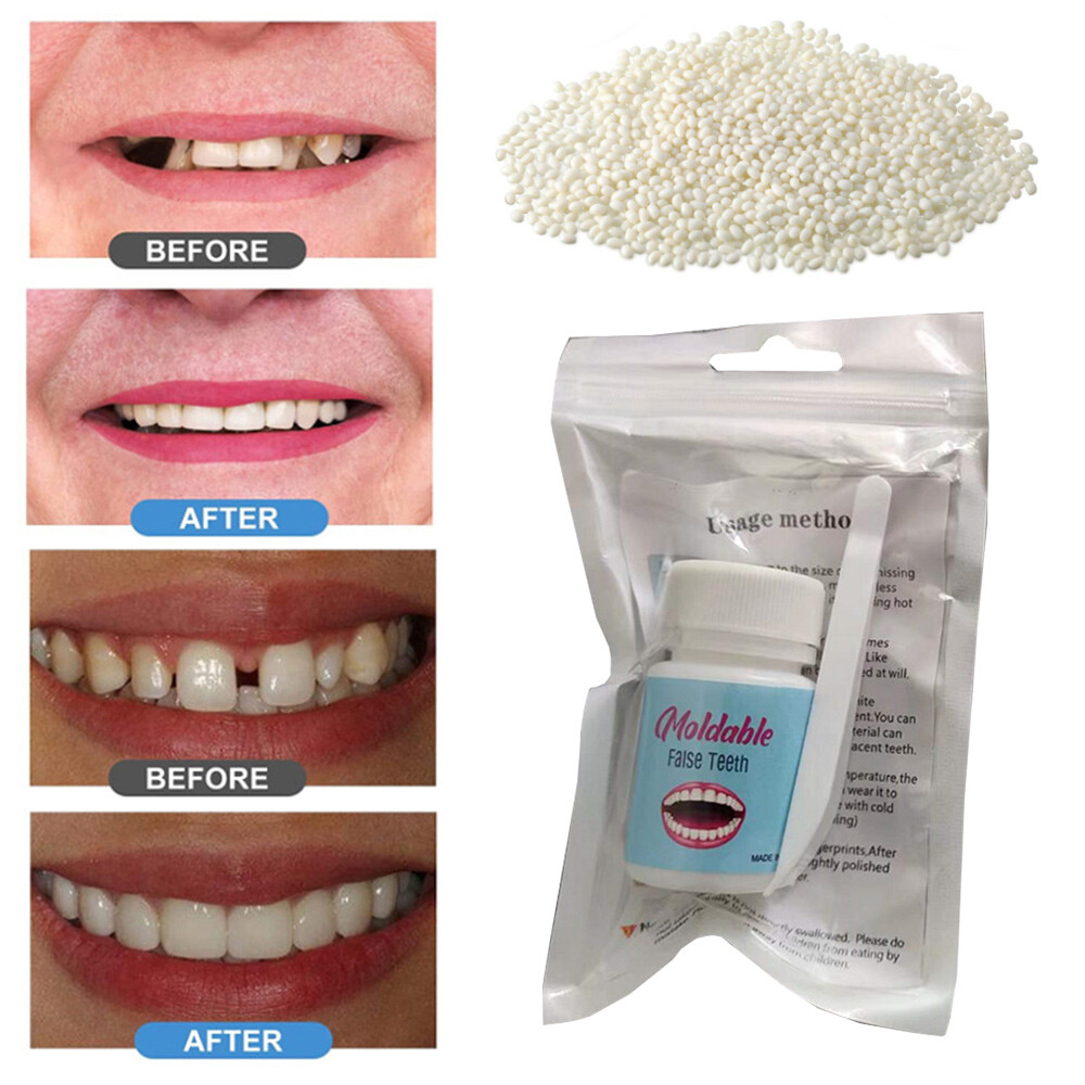 Resin False Teeth Solid Glue Temporary Tooth Repair Moldable Teeth Gap Denture⇖