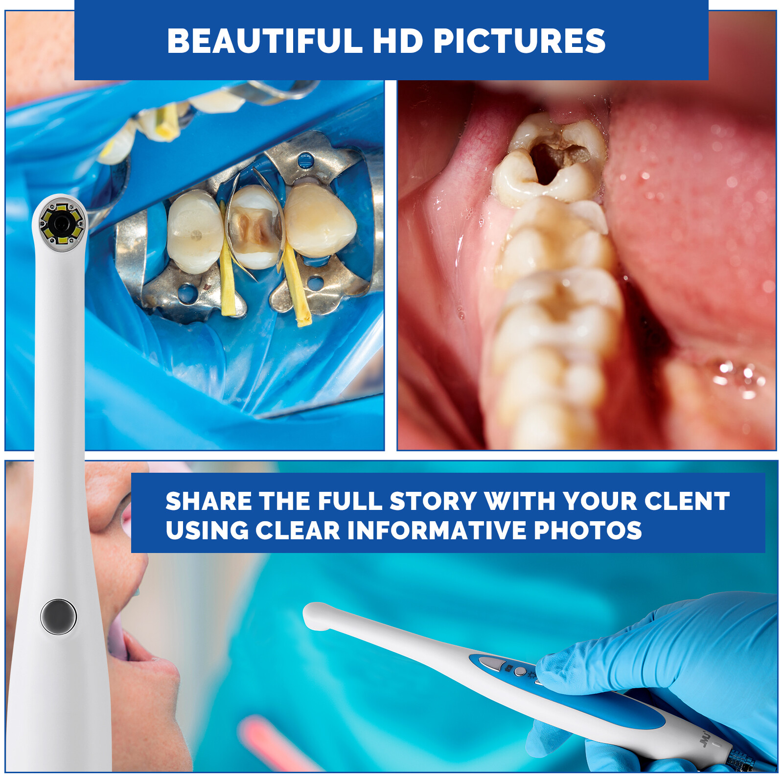 JMU Dental Intraoral Camera MD-280 Camera Capture Button Work on Dexis/Eaglesoft