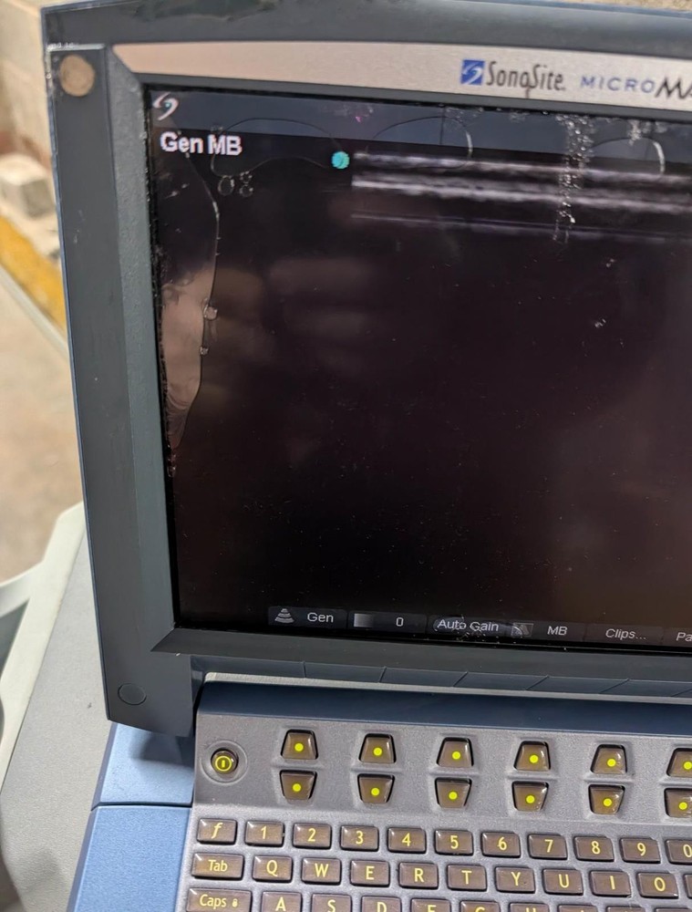 Sonosite MICROMAXX ULTRASOUND MACHINE