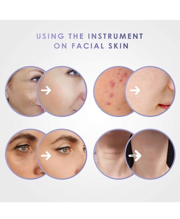 AOGNY RF Beauty Instrument - Model RF01