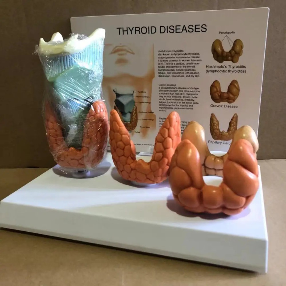 Thyroid Disease Lesion Anatomical Model Thyroid Anatomy Teaching Mode