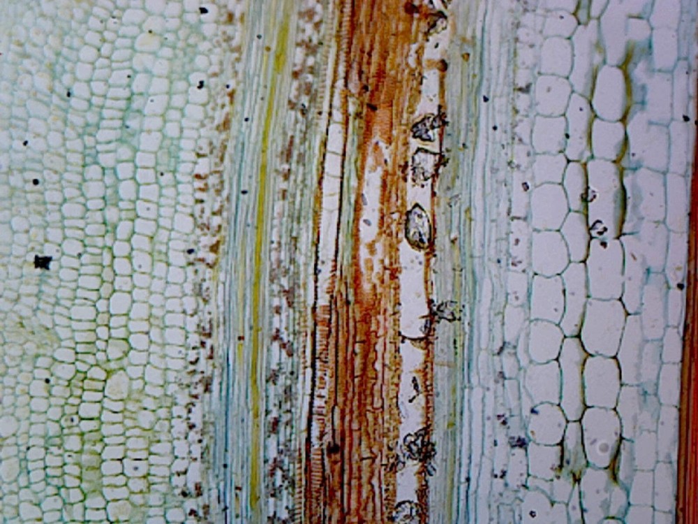 Pumpkin (Cucurbita) Stem; Longitudinal Section