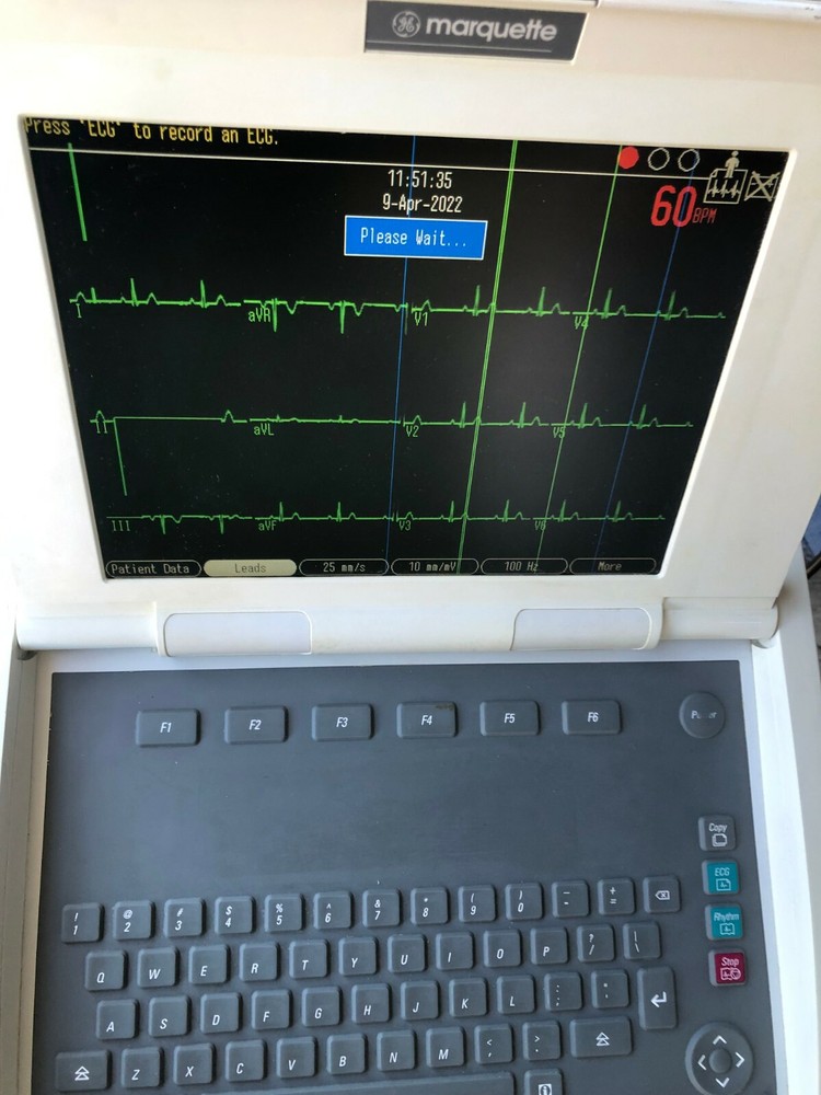 GE Marquette MAC 5000 ECG EKG System with CAM-14 Module