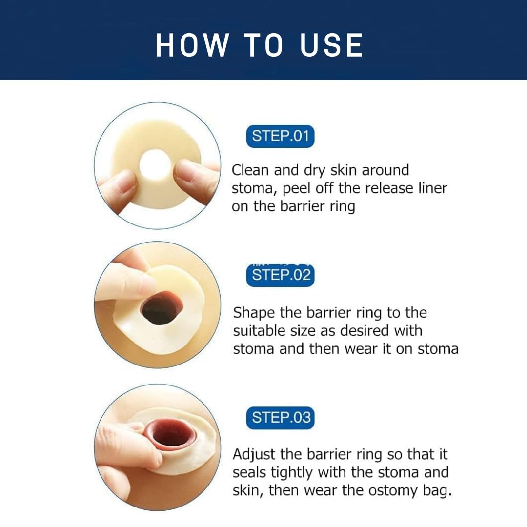 10 PCS Ostomy Barrier Rings, 2Mm Thickness Moldable Colostomy Rings, Medical Gra