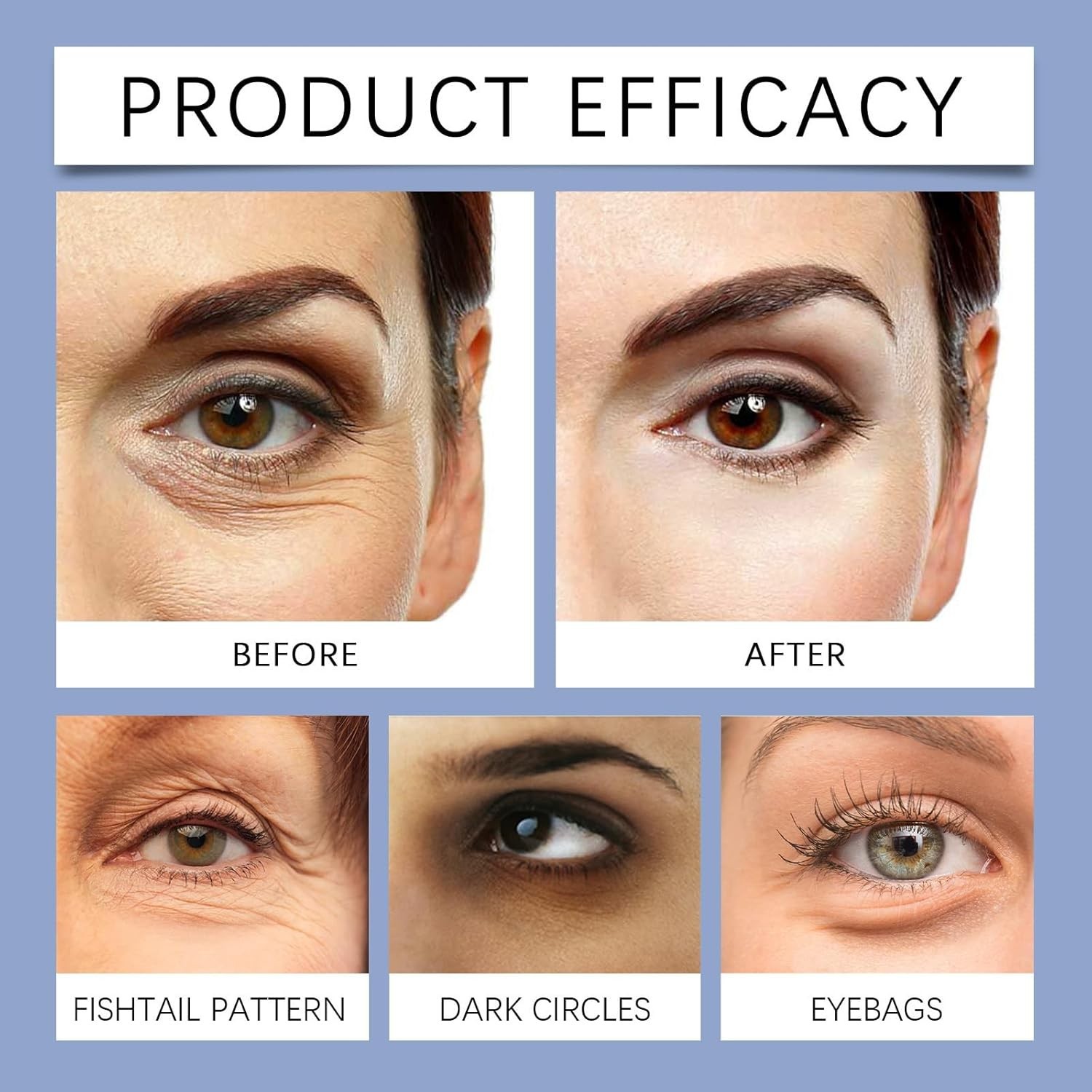 Novalift Microglow Eye Patches, 6 Pairs Hyaluronic Patches for under Eyes Bags