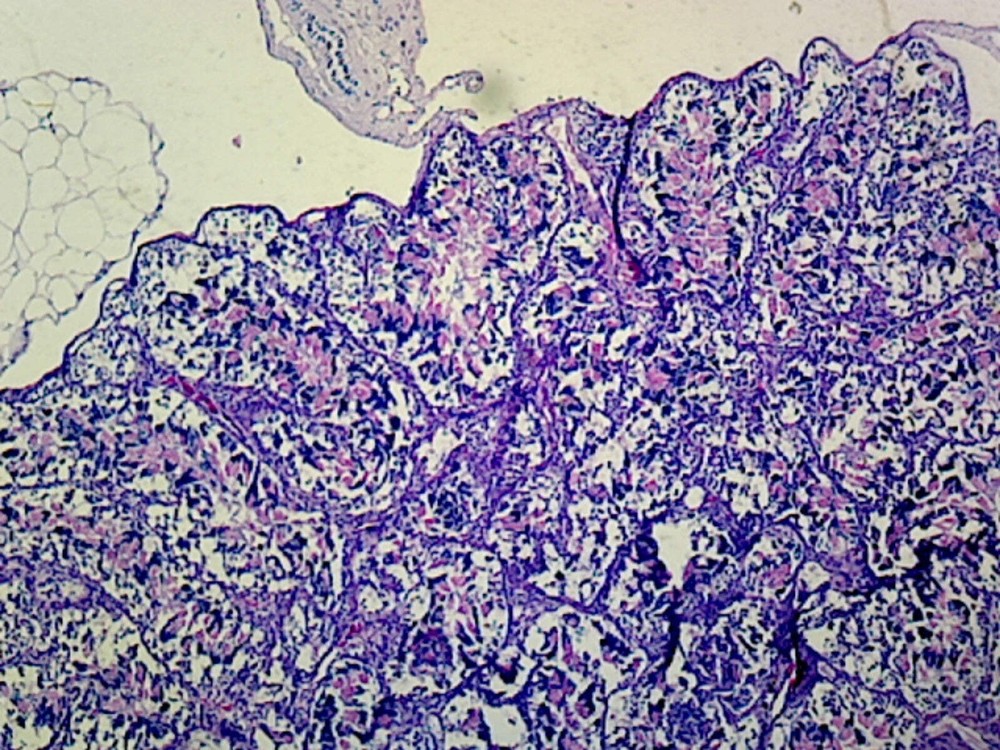 Frog Testis; Section; IH Stain