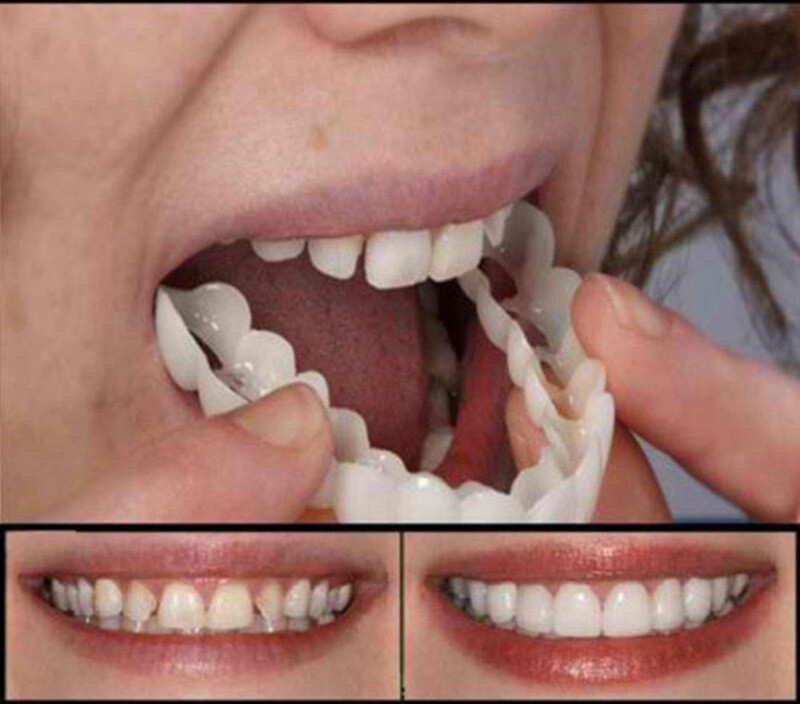High Quality Upper&Lower Fake Tooth Kit Teeth Veneers Denture False Teeth Cover