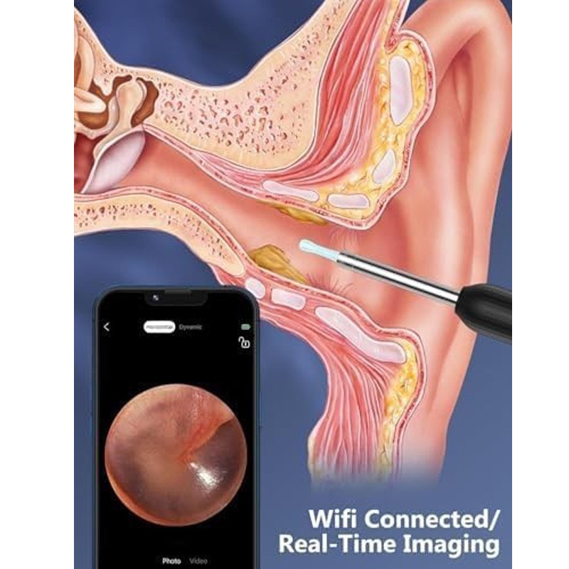 Wireless Ear Wax Remover Set with 8 Ear Set, Ear Cleaner Removal Kit with Camera