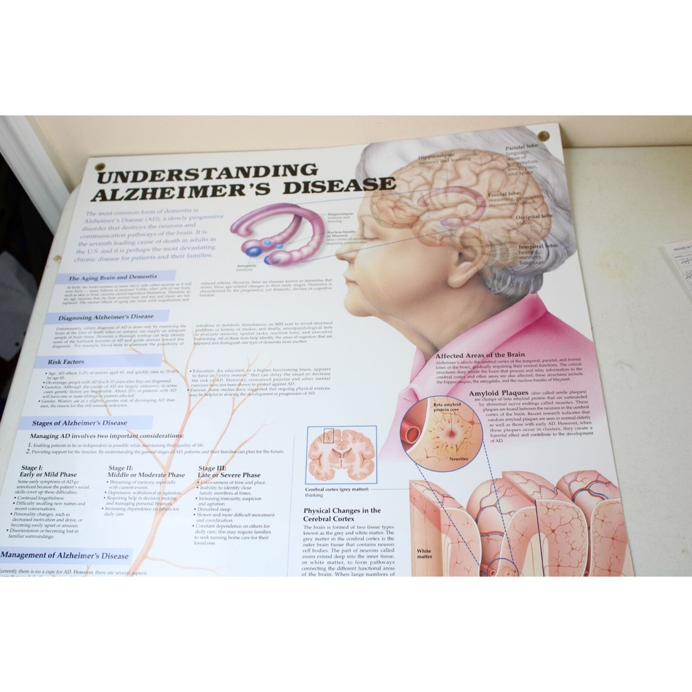 Wolters Kluwer Understanding Alzheimers Disease Chart Schematic 91285