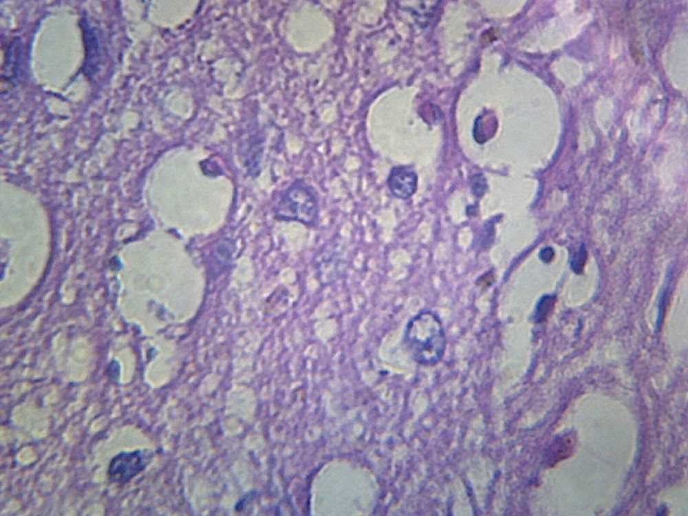 Cerebral Cortex, Human; Section