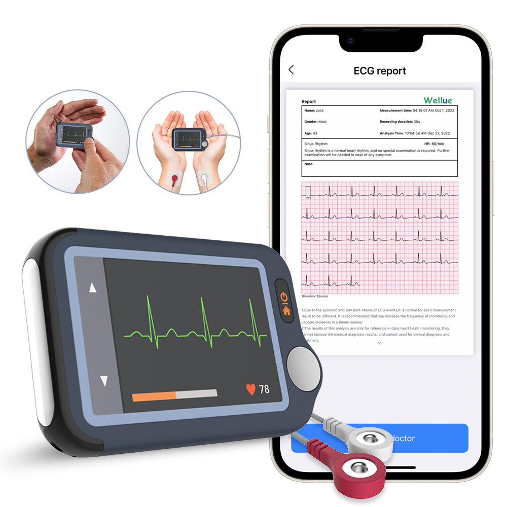 ECG EKG Monitor 30s/60s/5min Recording AI-ECG Analysis Report in App PC Software