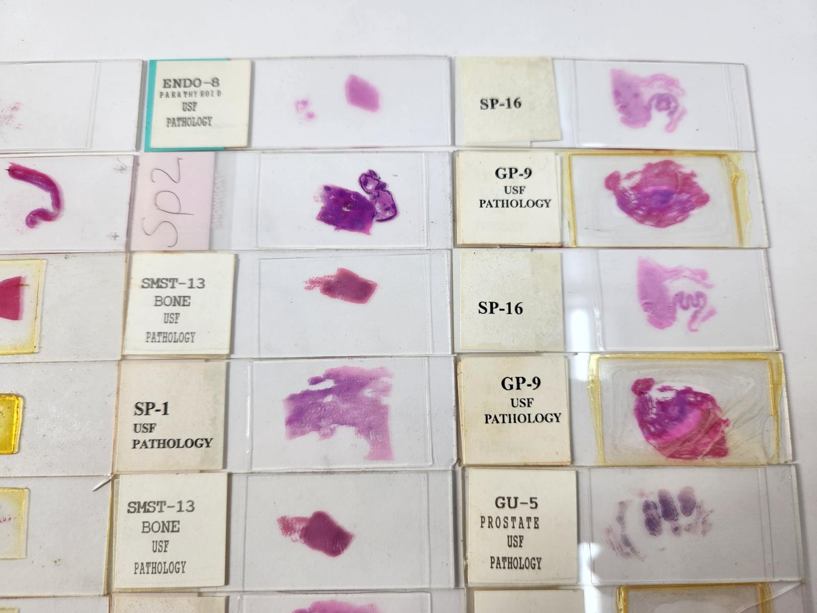 Lot Of 50 Vintage University Prepared Pathology Microscope Slides - Slides Only